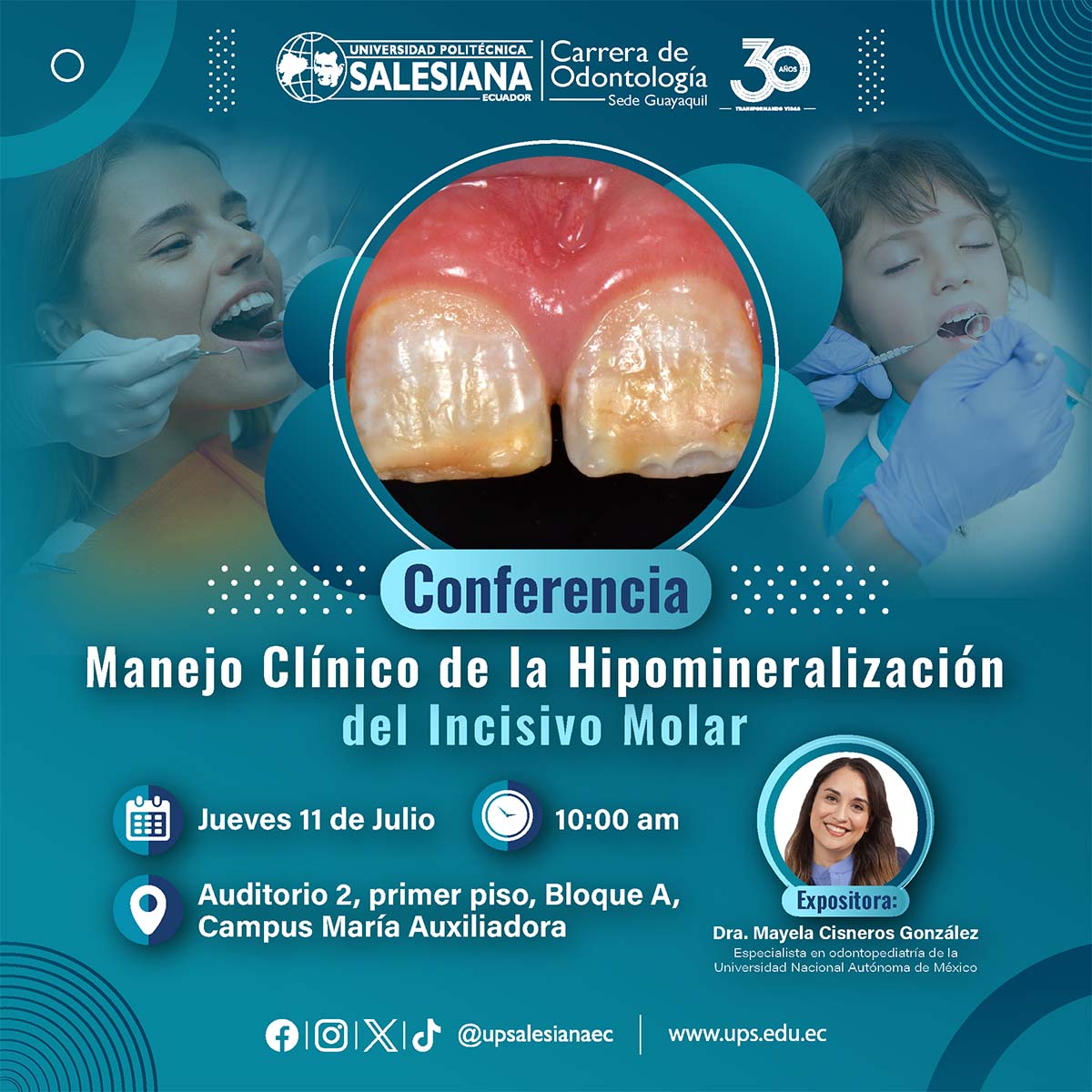 Afiche de la Conferencia: Manejo Clínico de Hipomineralización del Incisivo Molar
